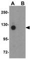 Protocadherin 18 antibody, GTX85299, GeneTex, Western Blot image 