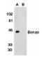 C-X-C Motif Chemokine Receptor 6 antibody, SP1286P, Origene, Western Blot image 