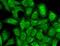 Potassium Sodium-Activated Channel Subfamily T Member 1 antibody, MA5-27609, Invitrogen Antibodies, Immunofluorescence image 