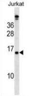 Placenta-specific protein 4 antibody, AP53328PU-N, Origene, Western Blot image 