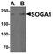 Protein SOGA1 antibody, PA5-72776, Invitrogen Antibodies, Western Blot image 