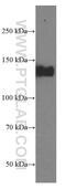 WARTS antibody, 66569-1-Ig, Proteintech Group, Western Blot image 