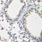 Bone Morphogenetic Protein 2 antibody, GTX64355, GeneTex, Immunohistochemistry paraffin image 