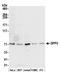 Dipeptidyl Peptidase 3 antibody, A305-408A, Bethyl Labs, Western Blot image 