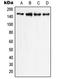 Phospholipase C Gamma 1 antibody, LS-C352671, Lifespan Biosciences, Western Blot image 