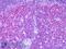 MARCKS-related protein antibody, LS-B6354, Lifespan Biosciences, Immunohistochemistry paraffin image 