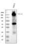 Collagen Type I Alpha 1 Chain antibody, PB9939, Boster Biological Technology, Western Blot image 