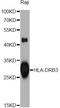 Major Histocompatibility Complex, Class II, DR Beta 3 antibody, MBS126371, MyBioSource, Western Blot image 