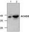 Acyl-CoA Dehydrogenase Short/Branched Chain antibody, TA318874, Origene, Western Blot image 