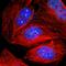 p53BP1 antibody, HPA008788, Atlas Antibodies, Immunofluorescence image 