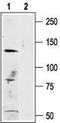 Transient Receptor Potential Cation Channel Subfamily M Member 1 antibody, TA328685, Origene, Western Blot image 