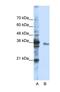 Exosome Component 3 antibody, NBP1-57209, Novus Biologicals, Western Blot image 