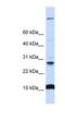 WD Repeat Domain 83 Opposite Strand antibody, NBP1-59969, Novus Biologicals, Western Blot image 