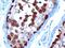 ADAMTS-like protein 2 antibody, 45-158, ProSci, Immunohistochemistry paraffin image 