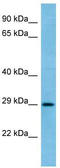 RAB6C, Member RAS Oncogene Family antibody, TA342968, Origene, Western Blot image 
