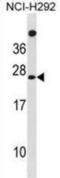 Mannose-P-Dolichol Utilization Defect 1 antibody, abx031453, Abbexa, Western Blot image 
