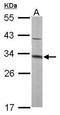 S-methyl-5 -thioadenosine phosphorylase antibody, TA308228, Origene, Western Blot image 