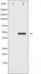 Calcium/Calmodulin Dependent Protein Kinase II Alpha antibody, TA325286, Origene, Western Blot image 