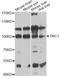 Transmembrane Channel Like 1 antibody, LS-C747704, Lifespan Biosciences, Western Blot image 