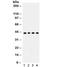 Adiponectin Receptor 1 antibody, R32299, NSJ Bioreagents, Western Blot image 