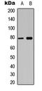 BCL6 Transcription Repressor antibody, LS-C358428, Lifespan Biosciences, Western Blot image 