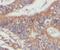 CYLD Lysine 63 Deubiquitinase antibody, FNab02142, FineTest, Immunohistochemistry frozen image 