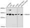 Tyrosine 3-Monooxygenase/Tryptophan 5-Monooxygenase Activation Protein Eta antibody, 23-787, ProSci, Western Blot image 
