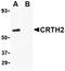 Catenin Beta 1 antibody, orb5768, Biorbyt, Western Blot image 