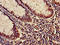 SYK antibody, A64076-100, Epigentek, Immunohistochemistry paraffin image 