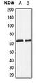 Hexosaminidase Subunit Beta antibody, GTX55224, GeneTex, Western Blot image 