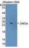 Angiopoietin-related protein 4 antibody, LS-C419898, Lifespan Biosciences, Western Blot image 