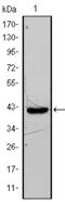 Fatty Acid Binding Protein 4 antibody, GTX83209, GeneTex, Western Blot image 