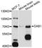 Disabled homolog 1 antibody, abx125745, Abbexa, Western Blot image 