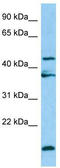 Legumain antibody, TA331334, Origene, Western Blot image 