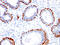 Tumor Protein P63 antibody, abx246739, Abbexa, Immunohistochemistry paraffin image 