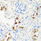 Carnitine O-palmitoyltransferase 2, mitochondrial antibody, 18-843, ProSci, Immunohistochemistry paraffin image 