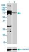 Serine/Threonine Kinase Like Domain Containing 1 antibody, MA5-23149, Invitrogen Antibodies, Western Blot image 