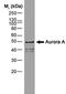 Aurora Kinase A antibody, GTX13824, GeneTex, Western Blot image 