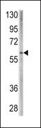 Bone Morphogenetic Protein Receptor Type 1A antibody, 60-840, ProSci, Western Blot image 