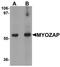 Myocardial Zonula Adherens Protein antibody, orb95602, Biorbyt, Western Blot image 