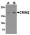 Kielin/chordin-like protein antibody, orb75823, Biorbyt, Western Blot image 