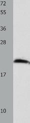 Fibroblast Growth Factor 12 antibody, TA322793, Origene, Western Blot image 
