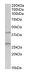 Fibroblast growth factor 23 antibody, orb125186, Biorbyt, Western Blot image 