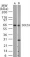 Suppressor of cytokine signaling 5 antibody, NB100-56639, Novus Biologicals, Western Blot image 