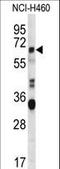 Endogenous Retrovirus Group FRD Member 1, Envelope antibody, LS-C166840, Lifespan Biosciences, Western Blot image 