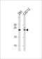 Ubiquitin Conjugating Enzyme E2 K antibody, 61-078, ProSci, Western Blot image 