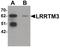 Leucine-rich repeat transmembrane neuronal protein 3 antibody, PA5-21098, Invitrogen Antibodies, Western Blot image 