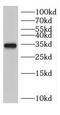 CDKN2A antibody, FNab02126, FineTest, Western Blot image 