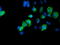 Sentrin-specific protease 2 antibody, LS-C175135, Lifespan Biosciences, Immunofluorescence image 
