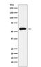 Aldehyde dehydrogenase, mitochondrial antibody, M00546, Boster Biological Technology, Western Blot image 